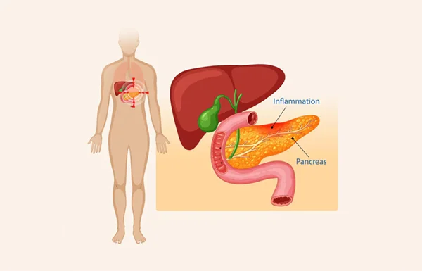 Biliopancreatic Diseases