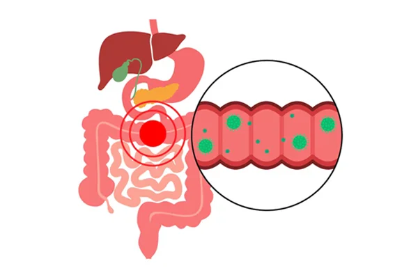 GI Infections